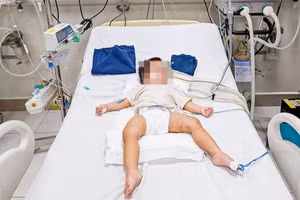 Bé gái hiện đang được điều trị tại Bệnh viện Nhi Trung ương.