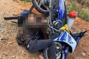 Nam thanh niên bị chân chống xe máy đâm vào má sau tai nạn.