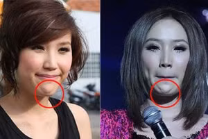 5 lần 7 lượt bị tung bằng chứng phẫu thuật thẩm mỹ, loạt mỹ nhân này vẫn "chối bay" 