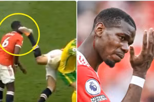 Sao Man Utd giận dữ vì bị đồng đội đá trúng đầu