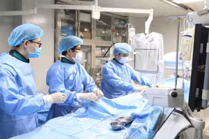 Bác sĩ can thiệp cho bệnh nhân đột quỵ tại Bệnh viện Đa khoa tỉnh Phú Thọ. Ảnh: BSCC 