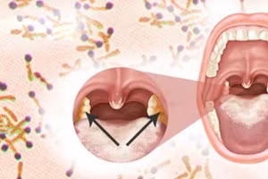 Ảnh minh họa: ITN