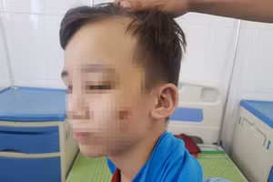 Trương Quang D. bị chủ quán bánh xèo bạo hành