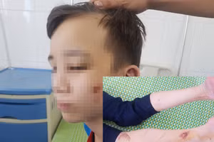 Em D. và những vết thương do bị chủ bạo hành