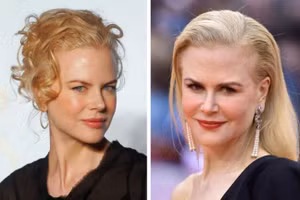 8 dấu hiệu trên mặt tiết lộ tuổi thật của phụ nữ