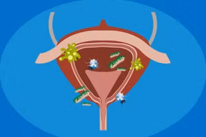 Điều gì sẽ xảy ra với cơ thể nếu nhịn tiểu quá lâu?