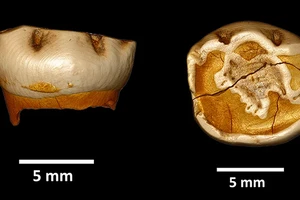 Phát hiện gây sốc từ chiếc răng lạ cổ xưa 
