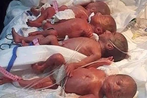 9 em bé đã chào đời sau một ca sinh mổ.