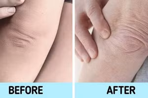 7 bộ phận cơ thể "tố cáo" tuổi thật bạn không thể giấu