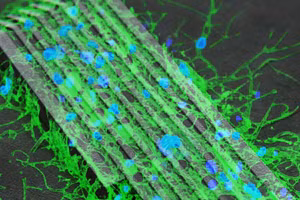 Robot siêu nhỏ được các nhà khoa học điều khiển bằng từ trường. Ảnh: ITN.