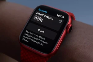 Người dùng lo lắng và tìm đến bác sỹ khi Apple Watch liên tục cảnh báo nhịp tim bất thường. Ảnh: The Verge.