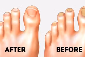 Mẹo hay giúp đôi bàn chân luôn nuột nà bất chấp giá rét