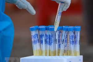 (Ảnh: TTXVN/Vietnam+).