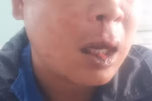 Anh Dương bị hành khách đánh dập cả mồm miệng.