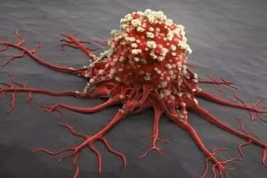 Có 4 thay đổi nhỏ trên cơ thể, có thể bệnh ung thư đang âm thầm tìm đến bạn