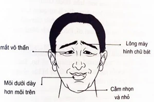 Tướng đàn ông đoản thọ yểu mệnh.