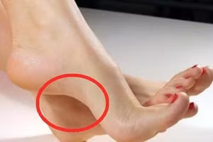 3 dấu hiệu "xấu đau xấu đớn" ở bàn chân lại vô cùng hút lộc