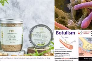 Bộ Y tế yêu cầu rà soát, báo cáo về các ca ngộ độc Pate Minh Chay