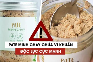 Các bệnh nhân ngộ độc pate Minh Chay vẫn tiên lượng nặng, thuốc giải độc gần 200 triệu/liều