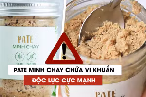 Các bệnh nhân ngộ độc pate Minh Chay vẫn tiên lượng nặng, thuốc giải độc gần 200 triệu/liều