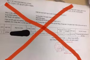 Văn bản giả mạo đã được chỉnh sửa kết quả xét nghiệm.