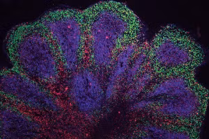 Các “bộ não nhỏ” cho thấy cấu trúc giống như vỏ não lớn.