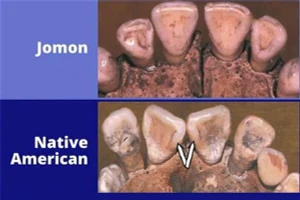 Nghiên cứu so sánh răng của người Jomon, Nhật Bản và người bản địa châu Mỹ.