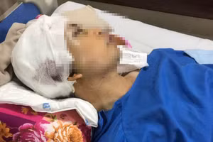 Ông Nguyễn Văn Hanh đang được tích cực điều trị.