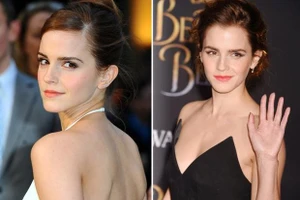 Triệu phú Emma Watson 