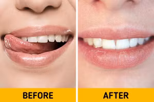 7 hiện tượng kỳ lạ xảy ra với cơ thể vào mùa đông