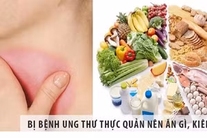 Ung thư thực quản đứng thứ 5 trong số các loại ung thư thường gặp.