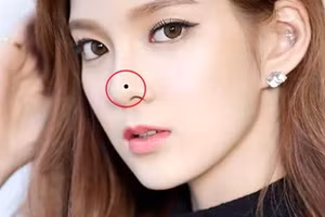 Người có 1 trong 6 nốt ruồi phước lành này ngồi không cũng có lộc