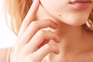 6 nốt ruồi phú quý, phụ nữ chỉ cần 1 đã đủ giàu sang