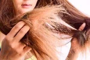 Thời tiết lạnh khô kéo dài cùng các tác động từ khói bụi, ô nhiễm và hóa chất khiến mái tóc hư tổn. Ảnh: STD.