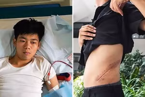 Vương Thượng Côn giờ đây phải nằm liệt giường vì vết mổ sau khi anh bán đi một quả thận của mình (phải) bị nhiễm trùng.