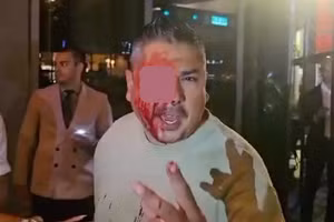 Cổ động viên bị 'sứt đầu mẻ trán' vì lén chụp ảnh Messi và vợ