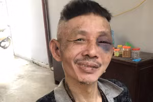 Đối tượng Nam bị bắt vì hành vi gây rối trật tự công cộn. Ảnh: Công an tỉnh Vĩnh Phúc