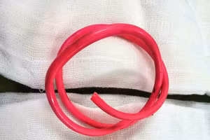 Đoạn dây điện dài khoảng 30cm được lấy ra từ bàng quang nam bệnh nhân - Ảnh: BVĐK tỉnh Tuyên Quang