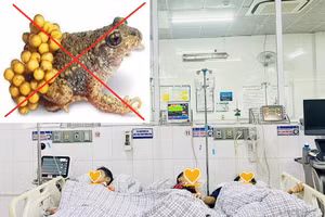 Ba mẹ con ở Phú Thọ phải nhập viện cấp cứu vì ngộ độc thịt và trứng cóc. Ảnh: BVĐK tỉnh Phú Thọ