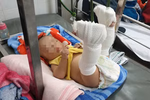 Bệnh nhi V. khi điều trị tại bệnh viện. Ảnh: VNN