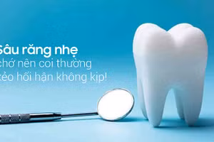 Sâu răng nhẹ có thể để lại hậu quả nghiêm trọng.