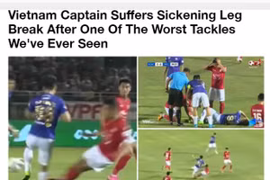 Báo nước ngoài đưa tin về pha bóng khiến Hùng Dũng gãy chân