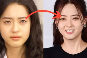 Nữ diễn viên hàng đầu Hàn Quốc sở hữu đôi mắt hiếm đặc biệt