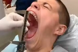 Chàng thiếu niên có chiếc miệng... rộng nhất hành tinh