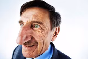 Người đàn ông sở hữu chiếc mũi dài nhất thế giới