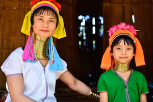 Những tiêu chuẩn sắc đẹp kỳ lạ ở các nước châu Á