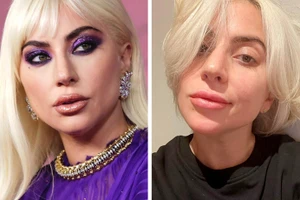 Bí quyết chăm sóc da trẻ mãi không già của Lady Gaga