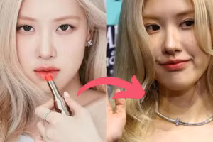 Rosé (BLACKPINK) vướng nghi vấn phẫu thuật thẩm mỹ