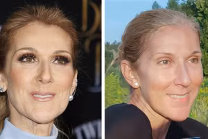 Mặt mộc đẹp không tì vết của Céline Dion, Katy Perry