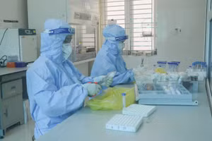 Người dân Điện Biên muốn xét nghiệm Covid-19 bằng kỹ thuật Realtime RT-PCR sẽ phải chi phí 734 nghìn đồng cho 1 lần thực hiện.